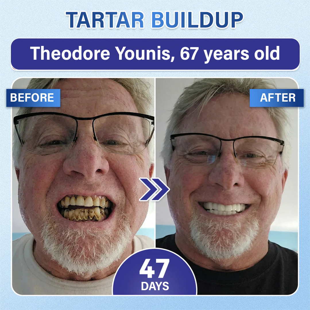 MIRYQA Tooth & Gum Repair Microneedle Patch — image 3