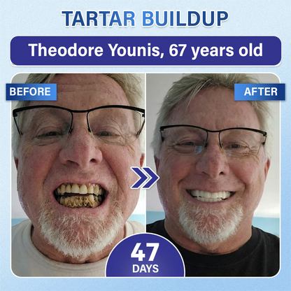 MIRYQA Tooth & Gum Repair Microneedle Patch — image 3