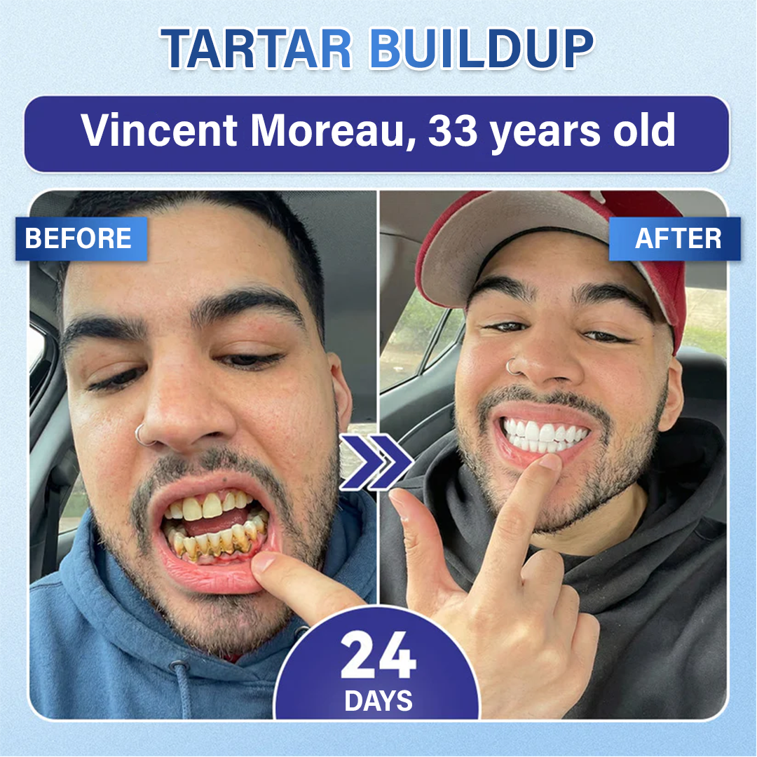 MIRYQA Tooth & Gum Repair Microneedle Patch — image 4